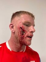 Screenshot_20260326_204428_Instagram.jpg Screenshot_20260326_204428_Instagram.jpg